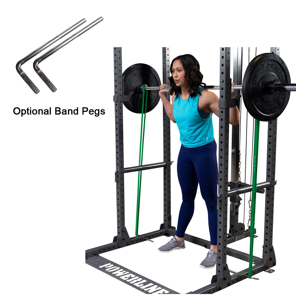 Optional PPRBP Band Pegs